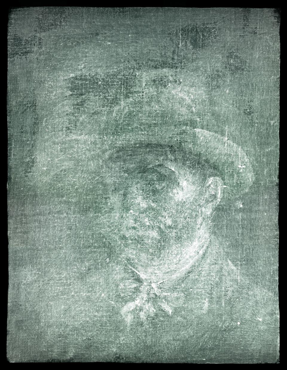  Röntgenaufnahme, die Vincent Van Gogh zeigt 
