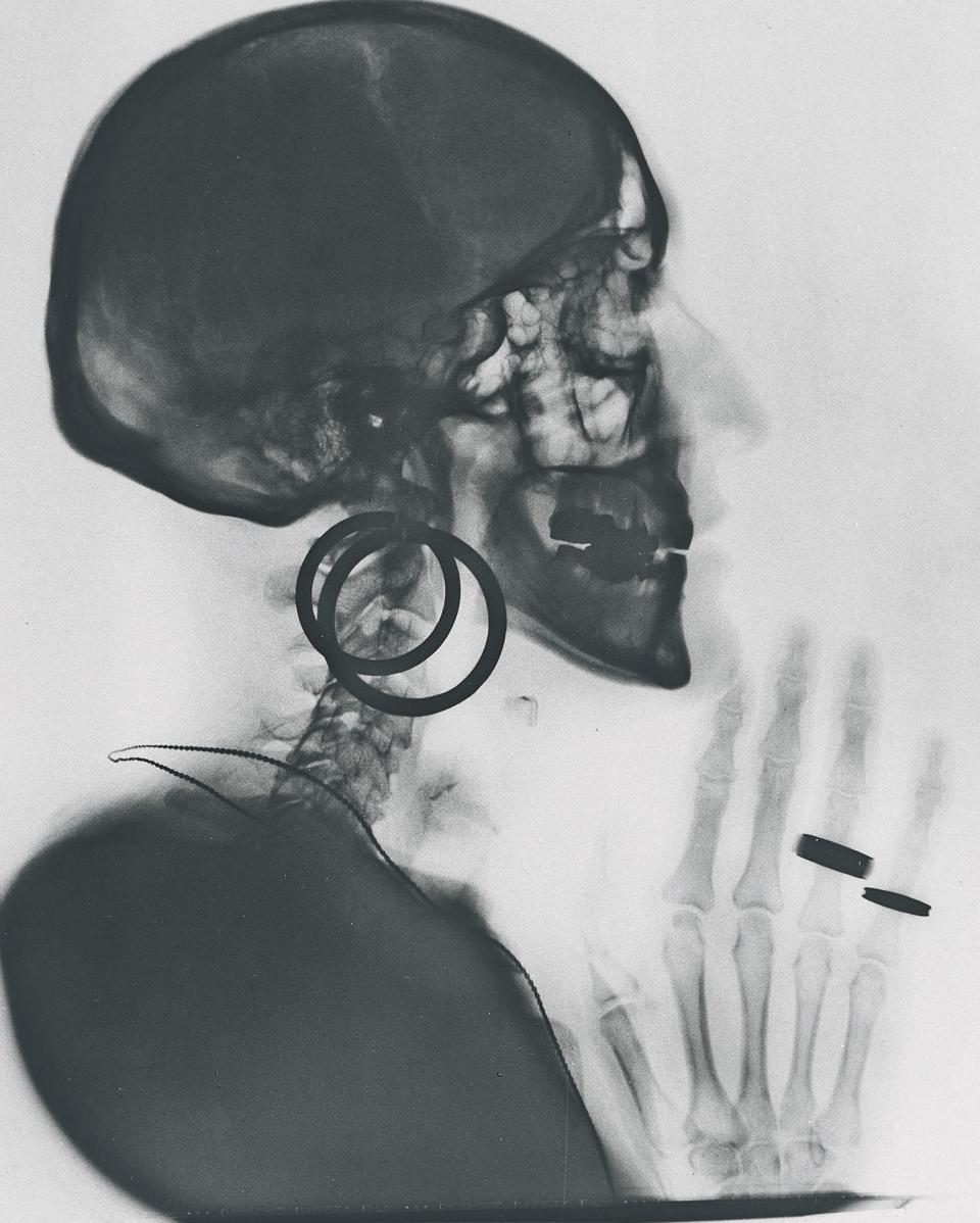 Meret Oppenheim "X-Ray of M.O.’s Skull", 1964/1981